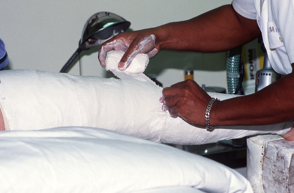 Blankets mummification. Plaster Cast.